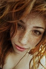 Those freckles
