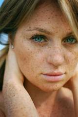 Freckled and beautiful