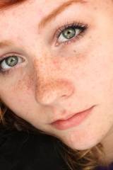 Red hair, green eyes and freckles!