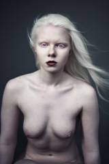 Pale isnt enough, what about albino girls!