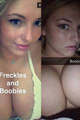 Freckles and boobs